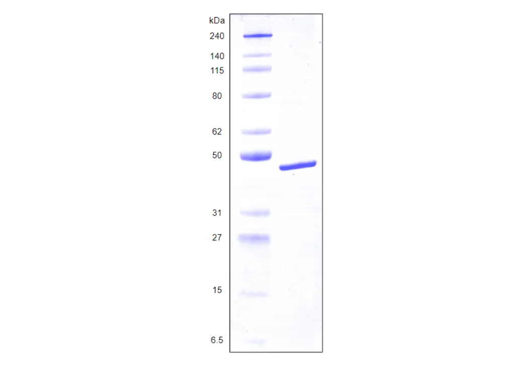 [MC04-100] Recombinant Human Galectin 8, variant 2, His Tag (359 a.a.) -100 ug
